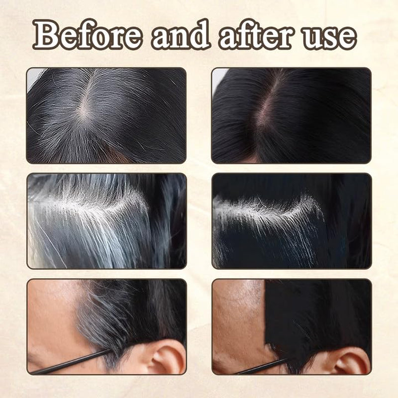 2 Pezzi di Polvere per Capelli Castano Scuro, Polvere per Capelli, Correttore per Capelli, Matite Colorate per Capelli con Pettine, Strumento per Coprire i Capelli Grigi per Donne e Uomini (40g, Marrone Scuro) Naty Shop Tinture per capelli