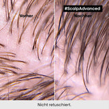 Shampoo detergente per cuoio capelluto grasso L'Oréal Professionnel, 300 ml Naty Shop Doccia e bagno