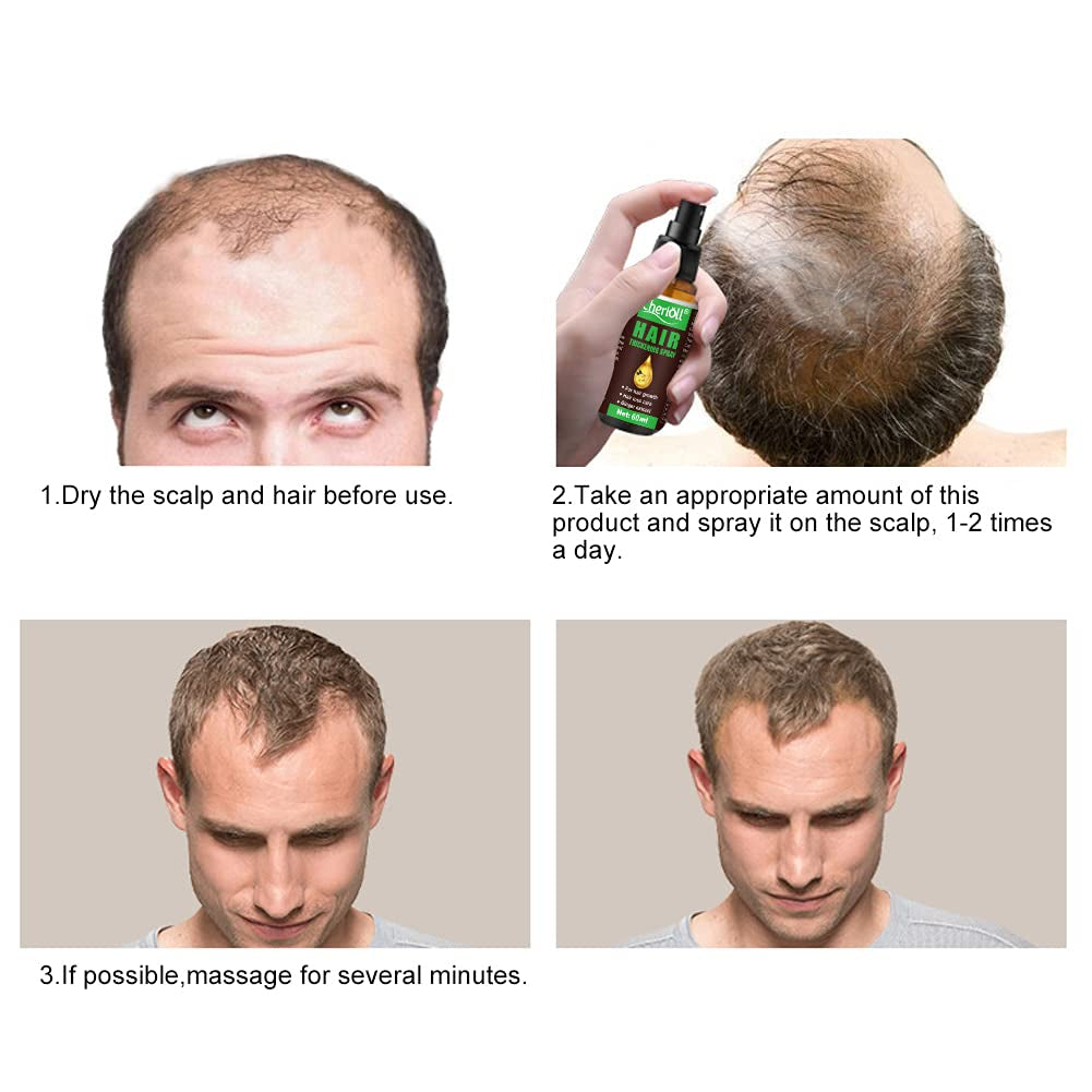 Crescita dei capelli, Anticaduta, Spray per la crescita dei capelli, Trattamento e perdita dei capelli, Per capelli diradati, Promuove una crescita dei capelli più spessi, più pieni e più veloce, Cura dei capelli da 60 ml Naty Shop