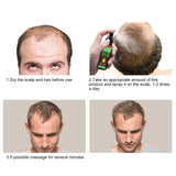 Crescita dei capelli, Anticaduta, Spray per la crescita dei capelli, Trattamento e perdita dei capelli, Per capelli diradati, Promuove una crescita dei capelli più spessi, più pieni e più veloce, Cura dei capelli da 60 ml Naty Shop