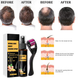 Kit per il trattamento avanzato della crescita dei capelli 30 ml 2 pezzi Spray per la crescita dei capelli Rullo per la crescita dei capelli e set di essenze Siero per la crescita dei capelli Anti caduta dei capelli Siero per la crescita dei capelli avanzato Cura dei capelli Naty Shop