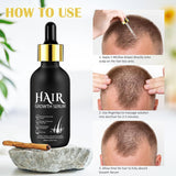 Olio biologico per la crescita dei capelli al 5% - Soluzione per uso esterno - Crescita e ispessimento dei capelli - Per perdita e diradamento dei capelli maschili - Riattiva i follicoli che si restringono - Dispenser a pompa preciso, Cura dei capelli da 60 ml Naty Shop