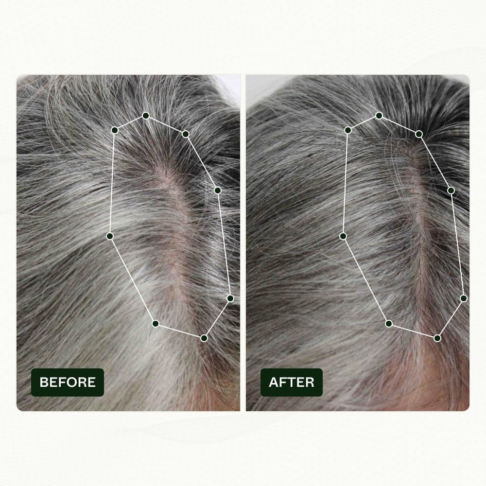 Routine di crescita dei capelli per donne di Scandinavian Biolabs con risultati clinicamente provati in 45 giorni | Trattamento contro la caduta dei capelli (Bio-Pilixin) Naty Shop Hair Care