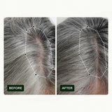 Routine di crescita dei capelli per donne di Scandinavian Biolabs con risultati clinicamente provati in 45 giorni | Trattamento contro la caduta dei capelli (Bio-Pilixin) Naty Shop Hair Care