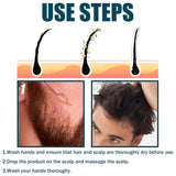 Miioto Siero per la crescita dei capelli Prodotto per la crescita dei capelli da uomo Crescita dei capelli Siero per capelli Cura del cuoio capelluto Promuovere capelli più spessi Nutrire il cuoio capelluto Prevenire la perdita dei capelli 3*60ML Cura dei capelli Naty Shop