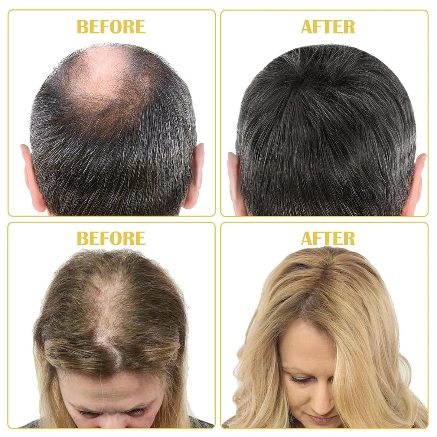 Olio biologico per la crescita dei capelli al 5% - Soluzione per uso esterno - Crescita e ispessimento dei capelli - Per perdita e diradamento dei capelli maschili - Riattiva i follicoli che si restringono - Dispenser a pompa preciso, Cura dei capelli da 60 ml Naty Shop