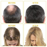 Olio biologico per la crescita dei capelli al 5% - Soluzione per uso esterno - Crescita e ispessimento dei capelli - Per perdita e diradamento dei capelli maschili - Riattiva i follicoli che si restringono - Dispenser a pompa preciso, Cura dei capelli da 60 ml Naty Shop