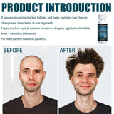 Miioto Siero per la crescita dei capelli Prodotto per la crescita dei capelli da uomo Crescita dei capelli Siero per capelli Cura del cuoio capelluto Promuovere capelli più spessi Nutrire il cuoio capelluto Prevenire la perdita dei capelli 3*60ML Cura dei capelli Naty Shop