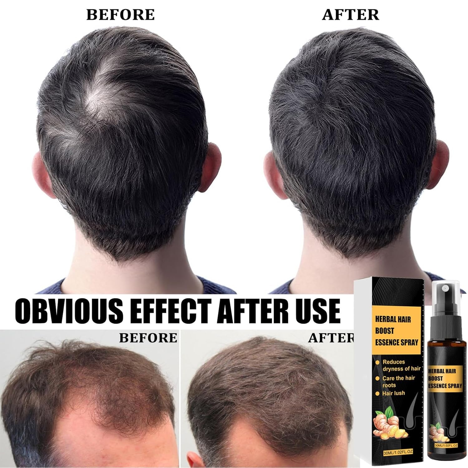 Kit per il trattamento avanzato della crescita dei capelli 30 ml 2 pezzi Spray per la crescita dei capelli Rullo per la crescita dei capelli e set di essenze Siero per la crescita dei capelli Anti caduta dei capelli Siero per la crescita dei capelli avanzato Cura dei capelli Naty Shop