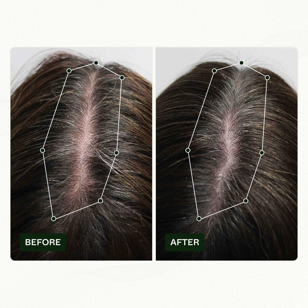 Routine di crescita dei capelli per donne di Scandinavian Biolabs con risultati clinicamente provati in 45 giorni | Trattamento contro la caduta dei capelli (Bio-Pilixin) Naty Shop Hair Care