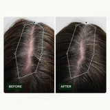Routine di crescita dei capelli per donne di Scandinavian Biolabs con risultati clinicamente provati in 45 giorni | Trattamento contro la caduta dei capelli (Bio-Pilixin) Naty Shop Hair Care