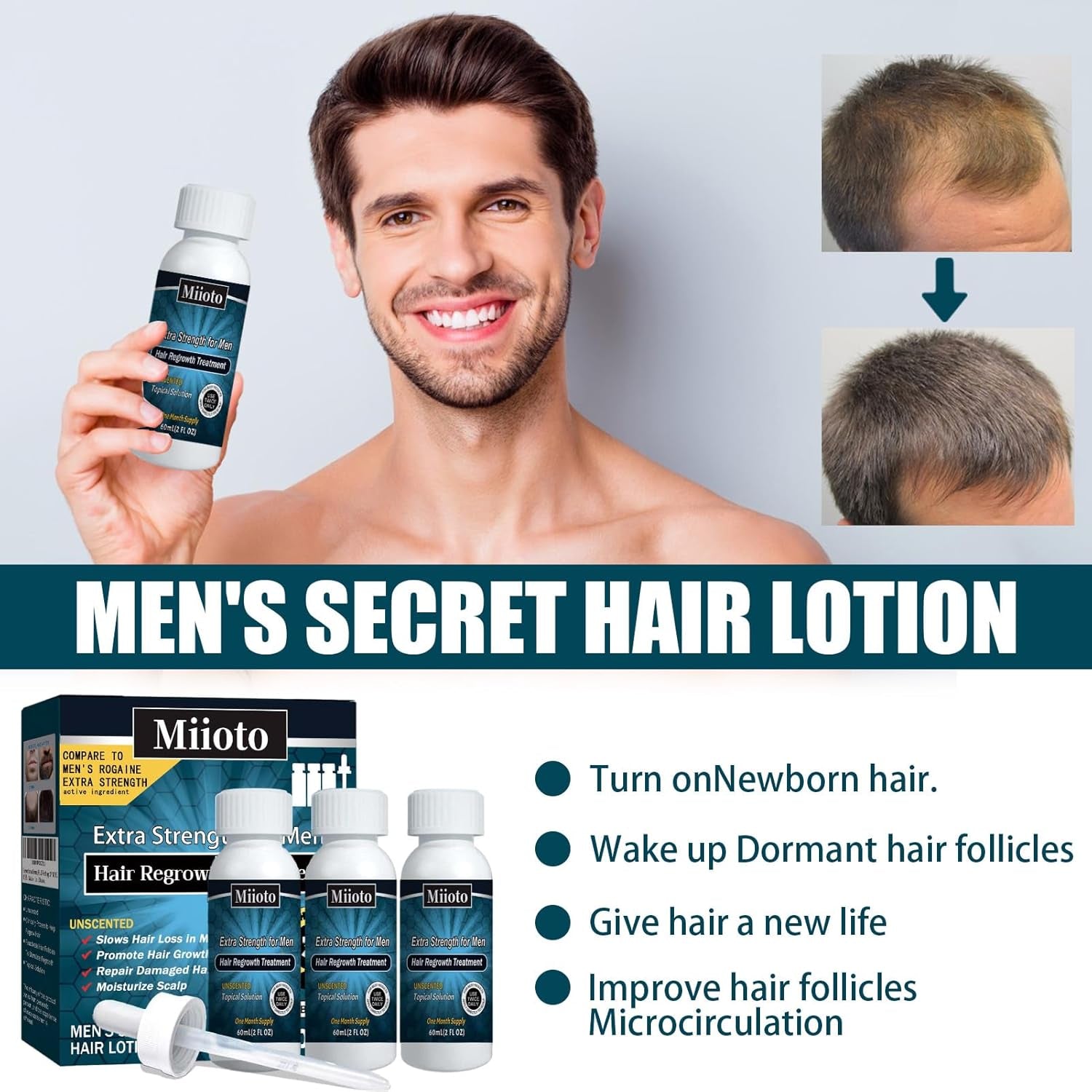 Miioto Siero per la crescita dei capelli Prodotto per la crescita dei capelli da uomo Crescita dei capelli Siero per capelli Cura del cuoio capelluto Promuovere capelli più spessi Nutrire il cuoio capelluto Prevenire la perdita dei capelli 3*60ML Cura dei capelli Naty Shop