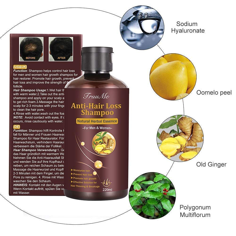 Shampoo per la crescita dei capelli, Shampoo anticaduta, Shampoo per la caduta dei capelli, Shampoo alle erbe naturali per una crescita più rapida dei capelli, Lozione Naty Shop Hair Care
