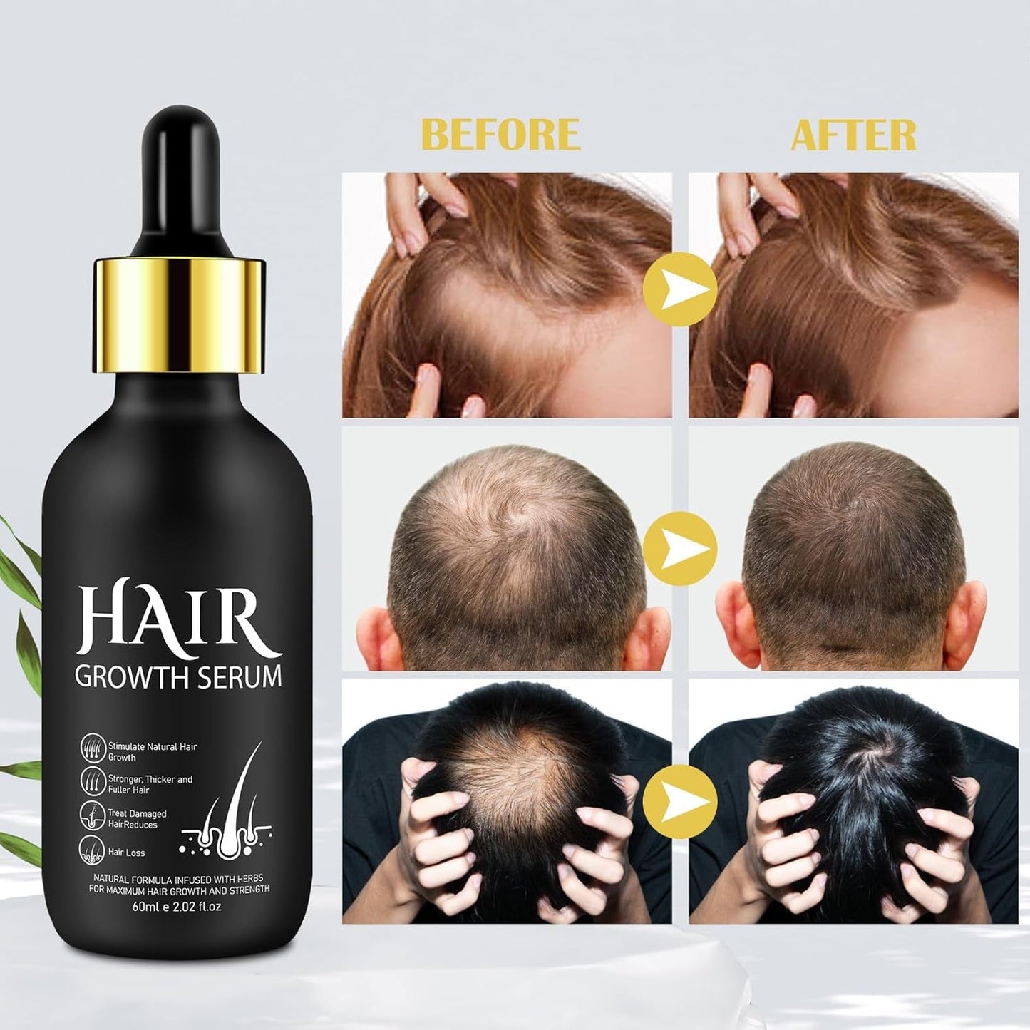 Olio biologico per la crescita dei capelli al 5% - Soluzione per uso esterno - Crescita e ispessimento dei capelli - Per perdita e diradamento dei capelli maschili - Riattiva i follicoli che si restringono - Dispenser a pompa preciso, Cura dei capelli da 60 ml Naty Shop