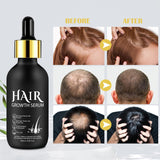 Olio biologico per la crescita dei capelli al 5% - Soluzione per uso esterno - Crescita e ispessimento dei capelli - Per perdita e diradamento dei capelli maschili - Riattiva i follicoli che si restringono - Dispenser a pompa preciso, Cura dei capelli da 60 ml Naty Shop