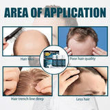 Miioto Siero per la crescita dei capelli Prodotto per la crescita dei capelli da uomo Crescita dei capelli Siero per capelli Cura del cuoio capelluto Promuovere capelli più spessi Nutrire il cuoio capelluto Prevenire la perdita dei capelli 3*60ML Cura dei capelli Naty Shop