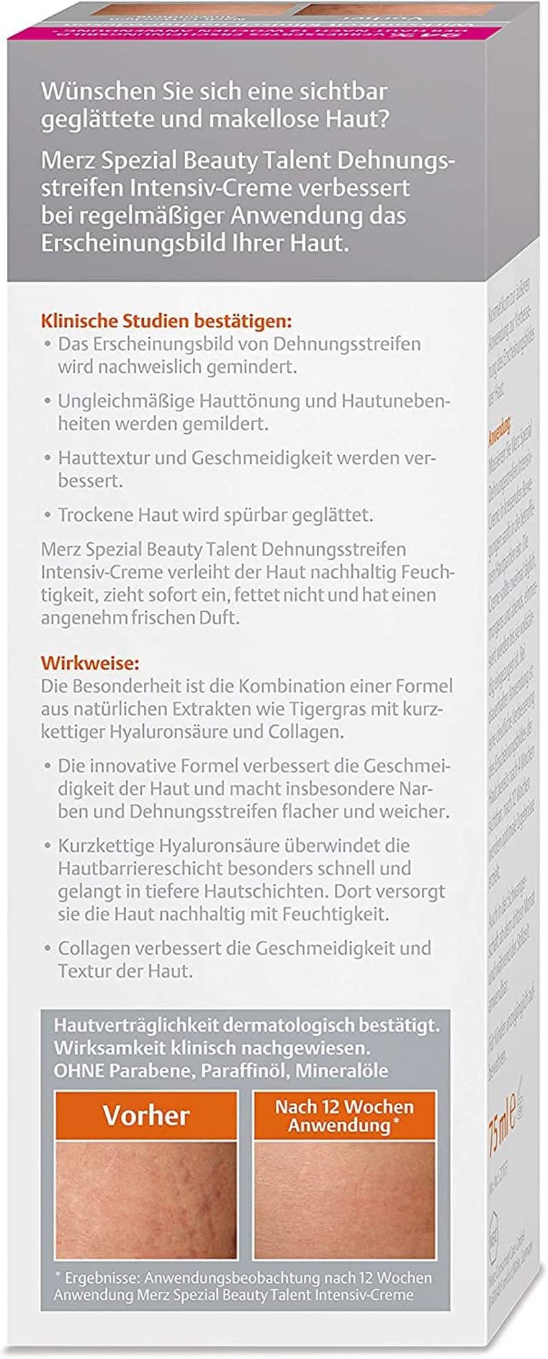 Merz Spezial, Crema intensiva antismagliature, 75 ml Cosmetici e Beauty Naty Shop
