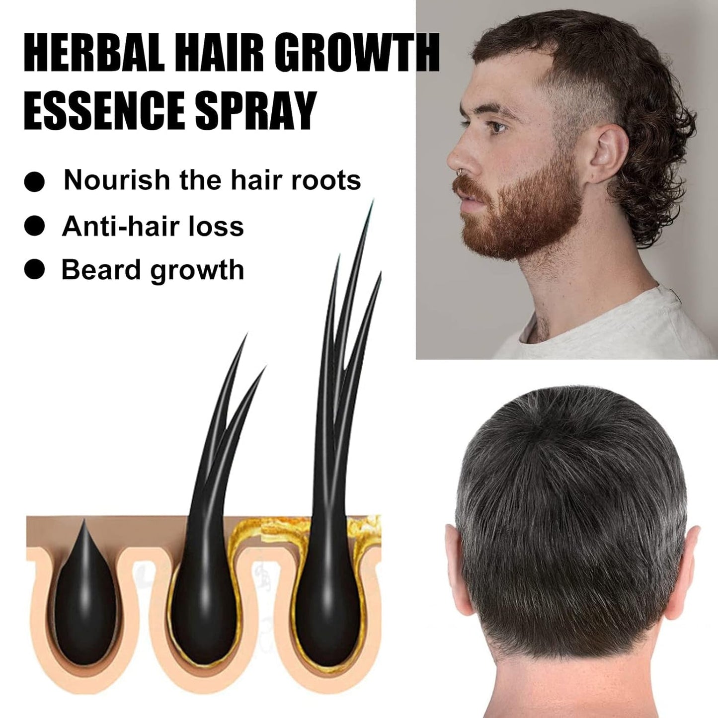 Kit per il trattamento avanzato della crescita dei capelli 30 ml 2 pezzi Spray per la crescita dei capelli Rullo per la crescita dei capelli e set di essenze Siero per la crescita dei capelli Anti caduta dei capelli Siero per la crescita dei capelli avanzato Cura dei capelli Naty Shop